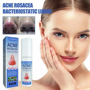 Jaysuing nhãn hiệu riêng mụn trứng cá rosacea điều trị Mũi Đỏ Thuốc mỡ huyết thanh acarus giết chết loại bỏ máu đỏ mũi sửa chữa da thô - Product Image 5
