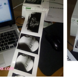 Portable Low Price Digital Ultrasound Video <b>Printer</b> Black and <b>White</b> Hybrid Graphic Thermal <b>Printer</b> <b>Printer</b> UP-X898MD - Product Image 6