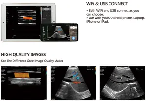 3 In 1 ponsel pintar cembung ganda Linear USB WIFI sonda de ultrasonido portabel PICC pemindai Ultrasound nirkabel