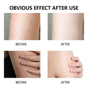 Gel de ducha refrescante de lavado corporal antibacteriano de árbol de té de hierbas de etiqueta privada para acné Eczema <span class=keywords><strong>Jock</strong></span> <span class=keywords><strong>Itch</strong></span> blanqueamiento efecto burbujeante - Product Image 5