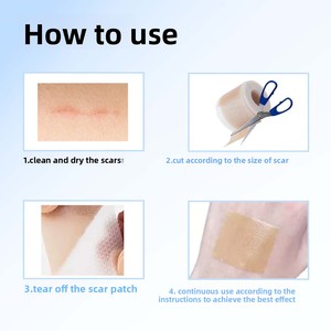 Nastro per la cura della cicatrice di bellezza e per la cura della cicatrice in Silicone di grado impermeabile di vendita calda - Product Image 4