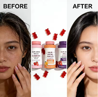 Gummies pour cheveux, peau et ongles très vendus, gummies à la biotine avec collagène et kératine pour adultes