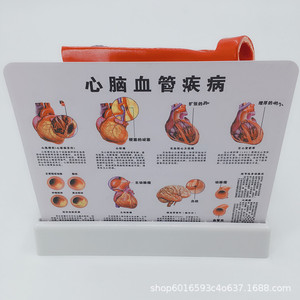 Modelo de anatomía vascular humana; modelo vascular; demostración de arteriosclerosis; vasos sanguíneos en diferentes etapas de edad. - Product Image 4