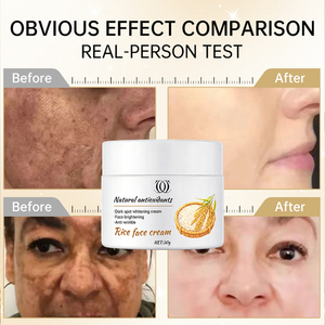 Crema Facial Blanqueadora con Retinol, Colágeno y Arroz, Ácido Hialurónico, Elimina Pecas, Desvanece Melasma, Ilumina la Piel Opaca, para Todo Tipo de Piel - Product Image 1