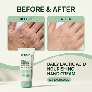 Crema de Manos con Ácido Láctico 12% AHA, Exfoliante, Suavizante y Nutritiva para Manos Secas, Ásperas y Agrietadas, Cuidado Reparador - Product Image 5