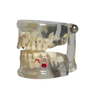 Factory Wholesale Transparent Children Dental Model Primary Teeth Deciduous Teeth Model for Teaching Demonstration