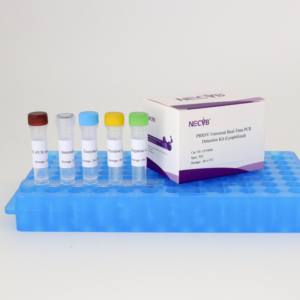 PRRSV-U 핵산 검출 키트 (동결 건조 실시간 형광 PCR) - Product Image 3