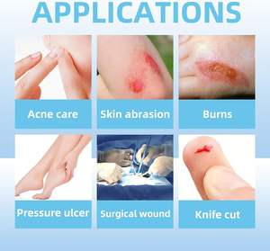 Apósito hidrocoloide adhesivo para heridas, parche para pies y dedos, apósito médico para quemaduras, apósito en gel - Product Image 2