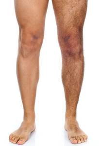 Depiladora <span class=keywords><strong>de</strong></span> depilación láser <span class=keywords><strong>de</strong></span> diodo profesional <span class=keywords><strong>de</strong></span> 808nm <span class=keywords><strong>de</strong></span> uso pClinic, depiladora Láser <span class=keywords><strong>de</strong></span> Diodo Láser <span class=keywords><strong>de</strong></span> 3 ondas para salón - Product Image 5