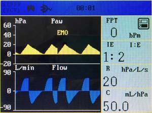 Hoge Kwaliteit Goedkope Prijs Puao Medische Apparatuur Fabrikant <span class=keywords><strong>Jinling</strong></span> <span class=keywords><strong>820</strong></span> Ziekenhuis Kliniek Chirurgie Anesthesie <span class=keywords><strong>Machine</strong></span> - Product Image 6