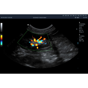 SYA-S90_vet veterinaria 15.6 pollici ad alta risoluzione a colori Doppler a ultrasuoni dispositivo diagnostico ecocardiografico macchina per animali domestici - Product Image 3
