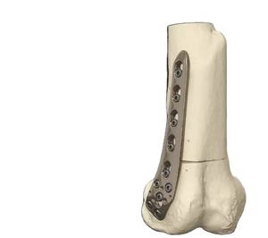 Impression 3D OEM Service Résine Blanche Résine Transparente Modèle d'Information Médicale Modèle de Pieds de Crâne avec Aller au Point de Support - Product Image 4