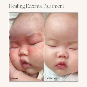 Krim Pelembap Wajah dan Tubuh Alami untuk Perawatan Eksim (Private Label) - Product Image 3