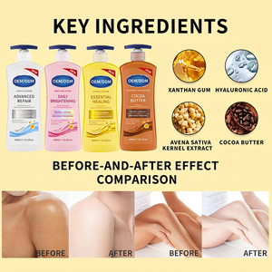 Lotion corporelle en gros 400 ml pour une hydratation intense, éclaircissante et réparatrice des peaux sèches – Crème en gros sous marque privée OEM - Product Image 1