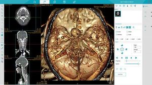 Medsinglong mesin CT pemindai <span class=keywords><strong>3D</strong></span>, tomografi komputer 32-iris spektral 2D - Product Image 5