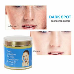 Crème Corporelle Éclaircissante 320g pour Soins de la Peau, <span class=keywords><strong>Anti</strong></span>-Taches Brunes, Résultat en 5 Jours, avec Glutathion - Product Image 3