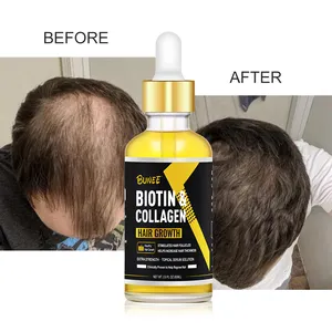 Penjualan Pabrik Produk Pertumbuhan Rambut Cepat Produk Perawatan Pertumbuhan Kembali Rambut Yang Efektif Baik Serum Pertumbuhan Rambut Jahe dengan Dermaroller