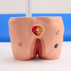 Modelo de Cuidado de Úlceras por Presión (<span class=keywords><strong>escaras</strong></span>) - Modelo para la Limpieza de Úlceras en Ancianos, Modelo de Entrenamiento - Product Image 4