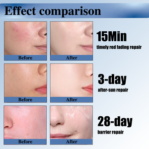G ครีมป้องกันผิวบอบบางจากเกาหลีใช้หลังการใช้สารเคมีเปลือกเลเซอร์หลังการอาบแดด - Product Image 5