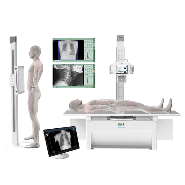 OEM/ODM Medical in One DR Radiography 32kw 50kw Digital X-ray Machine Electric Fixed Double Column X Ray Machine