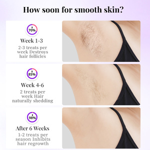 Épilateur IPL à refroidissement par saphir 510k, appareil portable pour l'épilation au laser, épilateur à lumière <span class=keywords><strong>pulsée</strong></span>, faible MOQ - Product Image 6