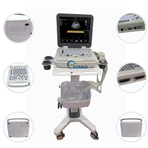 Échographie <span class=keywords><strong>Doppler</strong></span> de couleur d'ultrason humain de vétérinaire fiable idéale pour le diagnostic abdominal et cardiaque CU30-2 d'écho <span class=keywords><strong>Doppler</strong></span> <span class=keywords><strong>portatif</strong></span> - Product Image 3