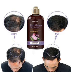 Private Label Onion Anti <strong>Hair</strong> Fall <strong>Oil</strong> and Shampoo Wellice <strong>Wow</strong> Red Onion Black Seed <strong>Oil</strong> Shampoo - Product Image 6