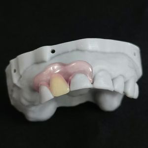Productos dentales removibles parciales sin metales, dentaduras temporales, dientes acrílicos flexibles, <span class=keywords><strong>Valplast</strong></span>, el precio más bajo para agente dental - Product Image 3