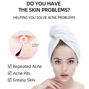 迅速に効果的な20g有機フェイトリートメントケアなだめるような抗発赤サリチル酸除去にきびゲル - Product Image 3