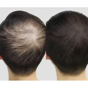 Lustrao olio per la ricrescita dei capelli - Product Image 6