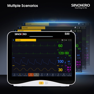 다중 파라미터 수의학 모니터 동물 건강 동물 환자 모니터 수의학 생체 신호 모니터 - Product Image 3