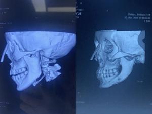 ฟิล์มสัตว์เลี้ยงกันน้ำปรับแต่งได้สำหรับ Epson/OKI/fuji/xerox pr-ct CR DR A4/A3/8x1 0/14X17ขนาด - Product Image 4