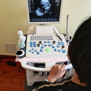 เครื่องอัลตราซาวนด์เคลื่อนที่อเนกประสงค์แบบพกพา รุ่น TC29 พร้อมระบบสีดอปเปลอร์ สำหรับการวินิจฉัยโรค - Product Image 6