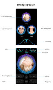 Appareil de mésothérapie haute pression 2026 en ABS pour rajeunissement cutané non invasif, lifting facial et soin du cuir chevelu - Product Image 3