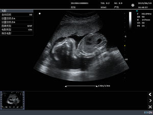 C10b Cor Doppler Ultrassom Máquina Dispositivo Portátil - Product Image 4