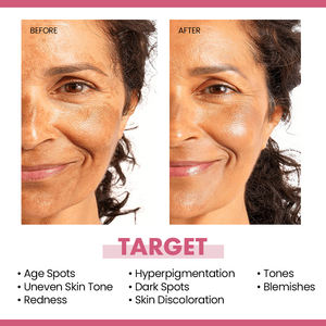 Marque privée Niacinamide B3 Hydratant pour le visage Produits de blanchiment de la peau Crème et lotion éclaircissantes pour le visage - Product Image 2