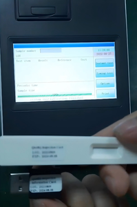 Analyseur POCT pour équipement vétérinaire EURVET, <span class=keywords><strong>ultra</strong></span> haute sensibilité, transmission de données en temps réel, compatible LIS/HIS, écran tactile - Product Image 5