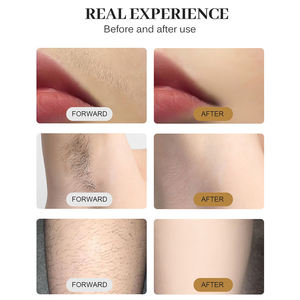 핫 세일 808 나노미터 다이오드 레이저 제모기 3파장 레이저 뷰티 장비 영구 제모 레이저 제모 - Product Image 4