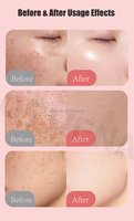 OTVENA Crème de Jour Blanchissante 4k Plus Thaïlandaise pour le Visage et le Corps, Meilleure Vente OTVENA