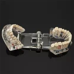 Modelo de dientes <span class=keywords><strong>para</strong></span> enseñanza Dental y entrenamiento - Product Image 3