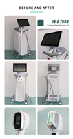 Produk Tren 2026 Epilator Depilasi 808 1064nm 755nm Mesin Penghilang Bulu Laser Diode Peremajaan Kulit Alat Kecantikan 2026