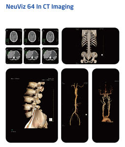 Tıbbi pozitron emisyonu tomografi PET CT tarama makinesi tümörler kalp, beyin hastalığı tanısı - Product Image 4