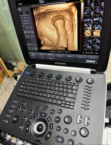 Fourniture et réparation de la machine à ultrasons portable HM70A - Product Image 4