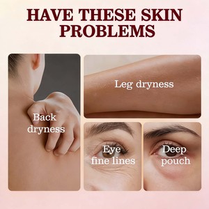 Olio di Ricino Biologico con Franchincenso per la Cura degli Occhi, Rivitalizzante e Idratante, Riduce Occhiaie, Gonfiore e Linee Sottili, Sicuro per la Pelle - Product Image 5