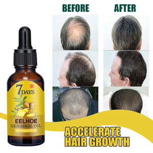 Eelhoe Huile Germinal 7 Jours 10ml 20ml 40ml Liquide de Croissance Capillaire au Gingembre Soin Hydratant Anti-Chute Sérum pour Femmes - Product Image 5