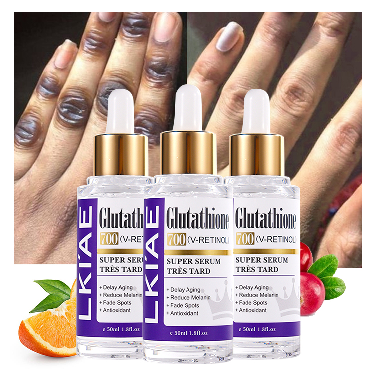 Private Label Glutathione Vitamin C Kojic Acid Hyaluronic Acid Reduce  Melanin Skin Whitening Facial Serum for Dark Spots Remover| Alibaba.com