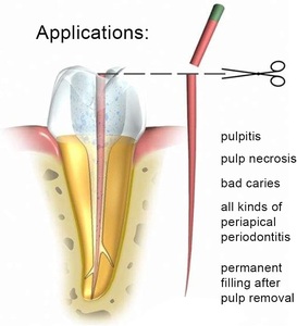 Approvisionnement Direct Usine de Pointes de Gutta-Percha Dentaires Endodontiques à Conicité 04 06 pour le Traitement des Canaux Radiculaires Dentaires - Product Image 6