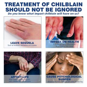 Bincan 18g <span class=keywords><strong>crema</strong></span> delicata a base di erbe tripla azione contro stafilococco/E.Coli/<span class=keywords><strong>Candida</strong></span> ipoallergenico per alleviare la pelle sensibile negli hotel - Product Image 4