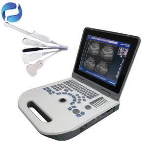 Sistema de Ultrasonido Digital Completo para Examen de Salud Animal, <span class=keywords><strong>Precio</strong></span> Directo de Fábrica - Product Image 6