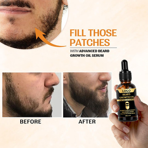 Cuidado de la Piel Vegano, Herbal, Nutritivo, Natural y Orgánico para Hombres, Aceite para Afeitar y Crecimiento de Barba, 30 ml, Venta al por Mayor - Product Image 5